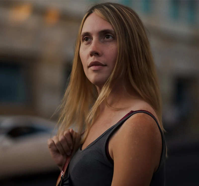 transgender woman blonde | Henderson Breast Reconstruction New York